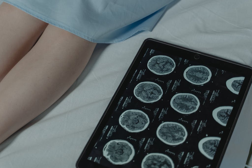 Kinervus Close-up of brain CT scan display on tablet beside patient's legs in a hospital room.